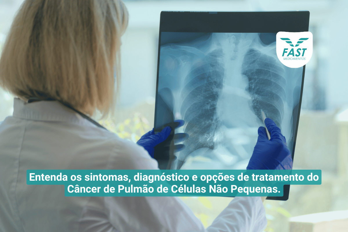 Médica observando raio-X do pulmão + subtitulo
