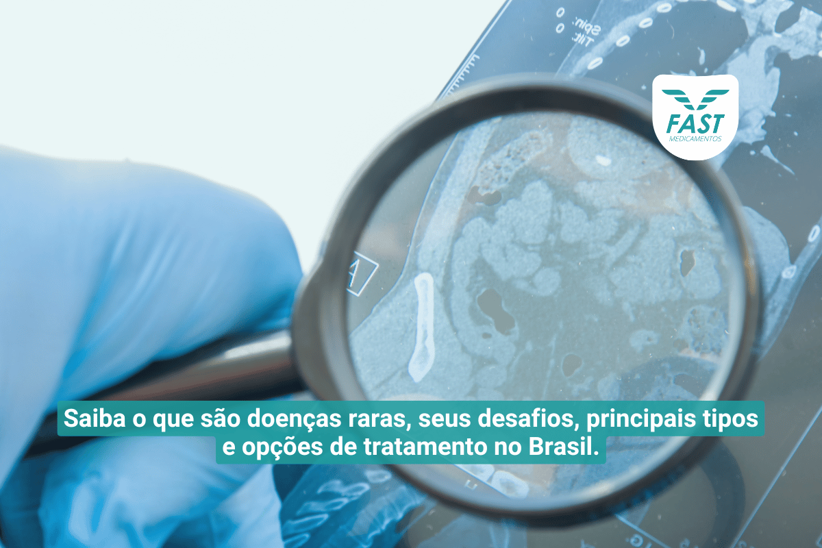 Médico analisando Raio-X de intestino com uma lupa + subtítulo