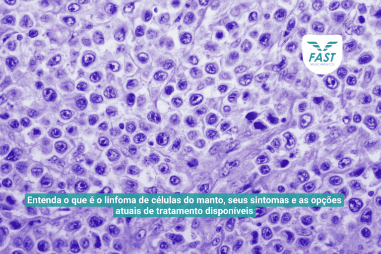 Representação da doença linfoma de células do manto
